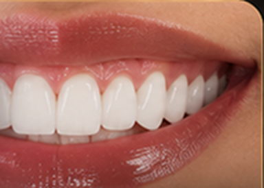 Sorriso depois do tratamento